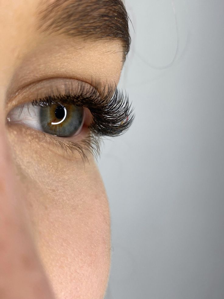 Hypotrichosis of Eyelashes Causes, Symptoms, and TreatmentHypotrichosis of Eyelashes Causes, Symptoms, and Treatment