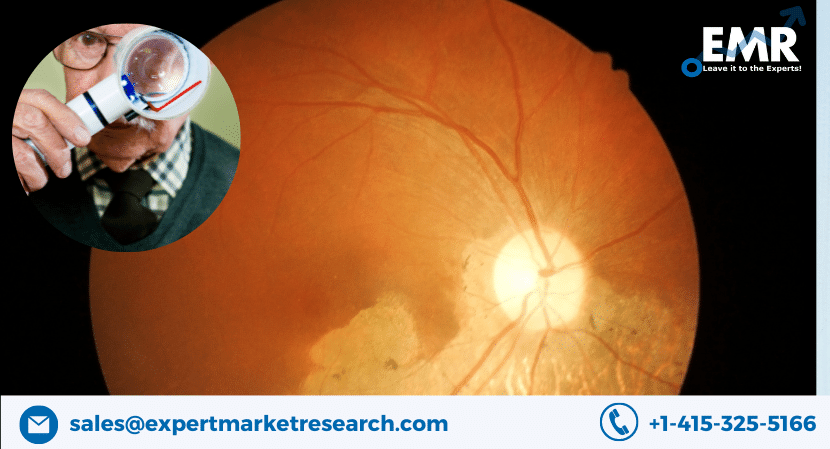 Age-Related Macular Degeneration (AMD) Market