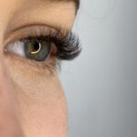 Hypotrichosis of Eyelashes Causes, Symptoms, and TreatmentHypotrichosis of Eyelashes Causes, Symptoms, and Treatment