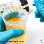 Urinalysis Market